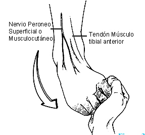 nervio-peroneo